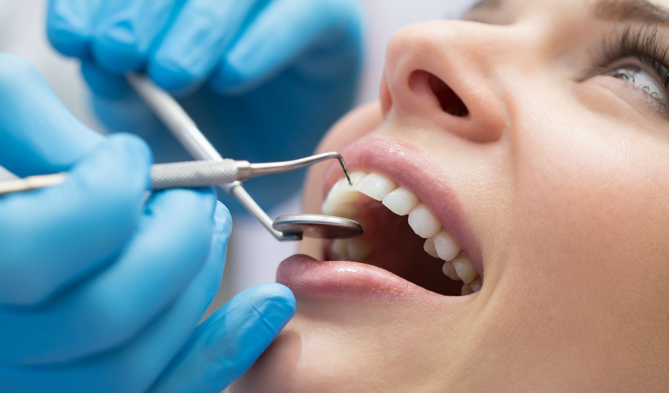 dental-exam-image-1